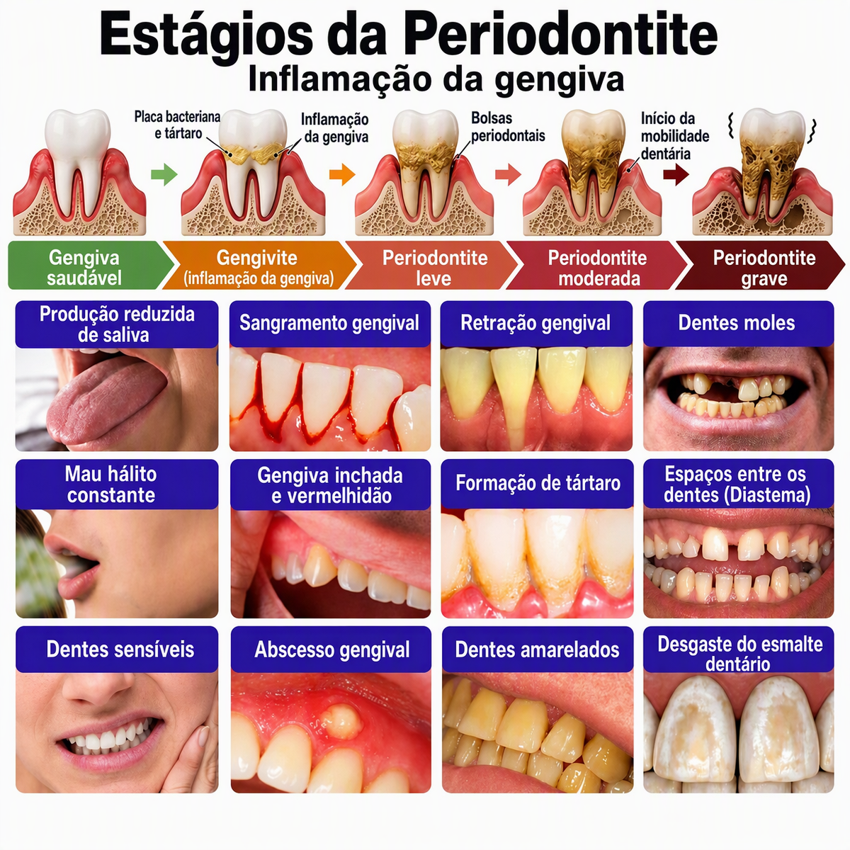 🇵🇹 Loja Oficial |🦷🧀 Rolimey® VioCore Pasta de dentes para o tratamento da inflamação das gengivas e da periodontite com veneno de abelha
