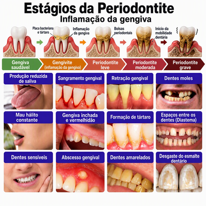 🇵🇹 Loja Oficial |🦷🧀 Rolimey® VioCore Pasta de dentes para o tratamento da inflamação das gengivas e da periodontite com veneno de abelha
