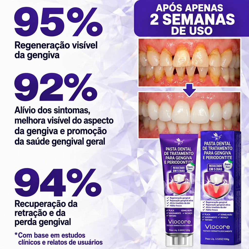 🇵🇹 Loja Oficial |🦷🧀 Rolimey® VioCore Pasta de dentes para o tratamento da inflamação das gengivas e da periodontite com veneno de abelha