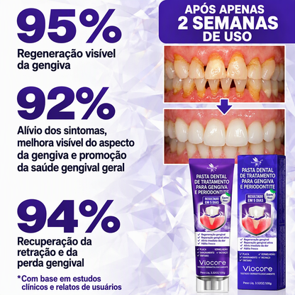 🇵🇹 Loja Oficial |🦷🧀 Rolimey® VioCore Pasta de dentes para o tratamento da inflamação das gengivas e da periodontite com veneno de abelha