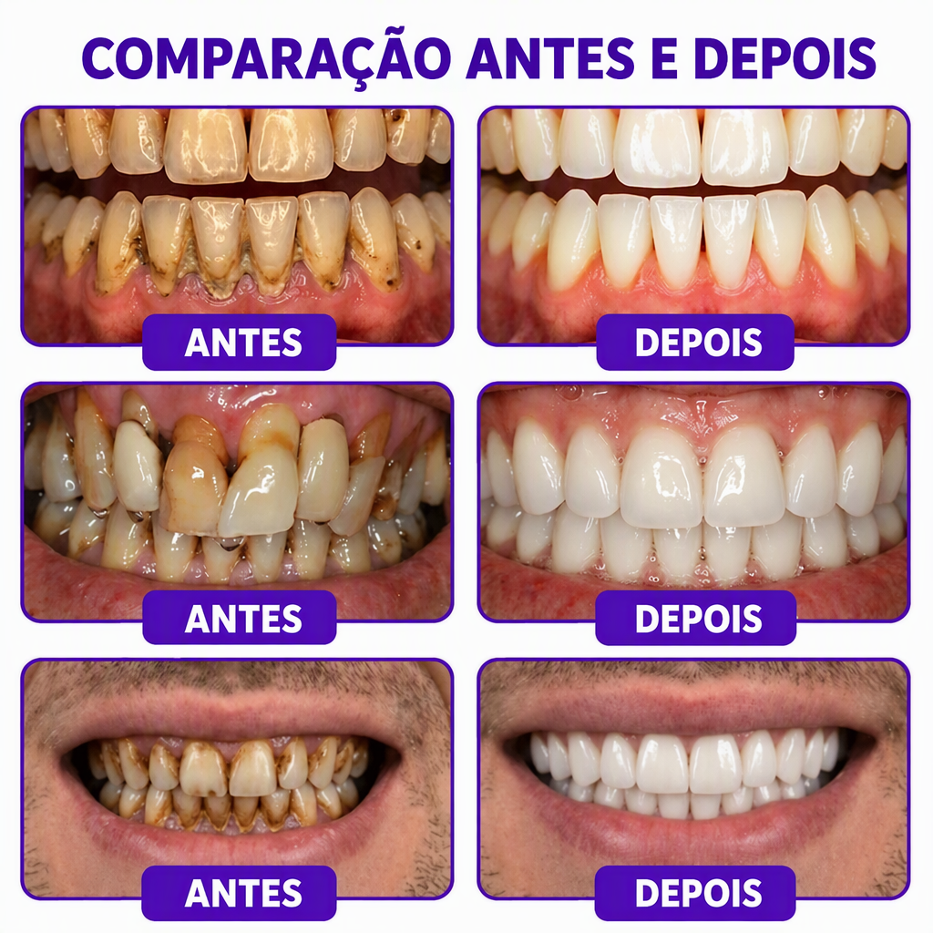 🇵🇹 Loja Oficial |🦷🧀 Rolimey® VioCore Pasta de dentes para o tratamento da inflamação das gengivas e da periodontite com veneno de abelha