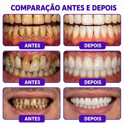 🇵🇹 Loja Oficial |🦷🧀 Rolimey® VioCore Pasta de dentes para o tratamento da inflamação das gengivas e da periodontite com veneno de abelha