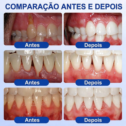 𝗔𝗧 👨‍⚕️ ❤️ 🔥 𝗘𝘃𝗼𝗹𝘃𝗶𝗼𝗻®𝗚𝘂𝗺𝗥𝗲𝘃𝗶𝘃𝗲𝗣𝗮𝗿𝗼𝗱𝗼𝗻𝘁𝗮𝗹-𝗥𝗲𝗽𝗮𝗿𝗮𝘁𝘂𝗿𝗴𝗲𝗹