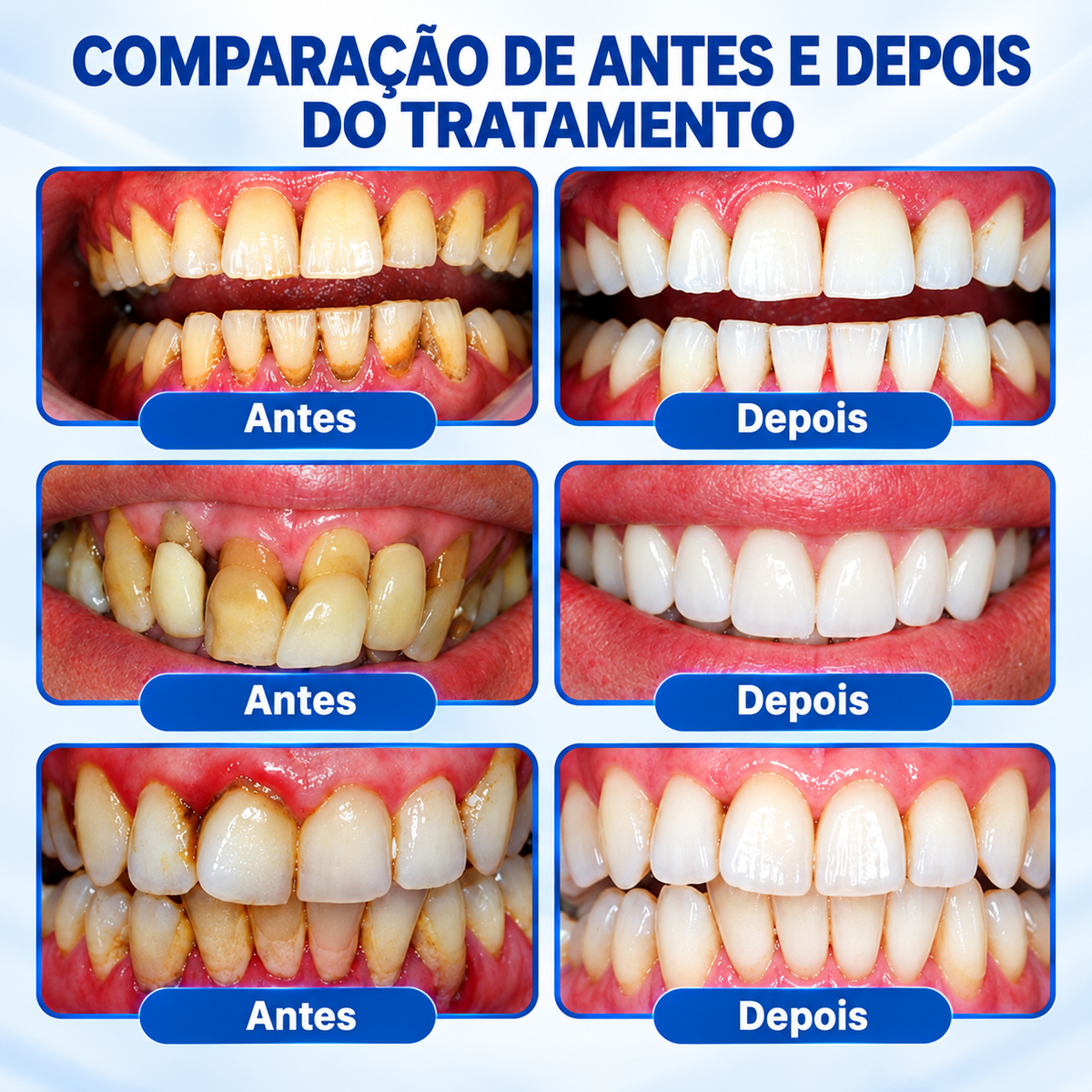 𝗔𝗧 👨‍⚕️ ❤️ 🔥 𝗘𝘃𝗼𝗹𝘃𝗶𝗼𝗻®𝗚𝘂𝗺𝗥𝗲𝘃𝗶𝘃𝗲𝗣𝗮𝗿𝗼𝗱𝗼𝗻𝘁𝗮𝗹-𝗥𝗲𝗽𝗮𝗿𝗮𝘁𝘂𝗿𝗴𝗲𝗹
