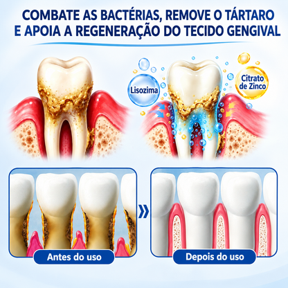 🇵🇹 Loja oficial |👨‍⚕️ ❤️ Evolvion® GumRevive — Gel de reparação periodontal | Certificado pela Ordem dos Médicos Dentistas (OMD)