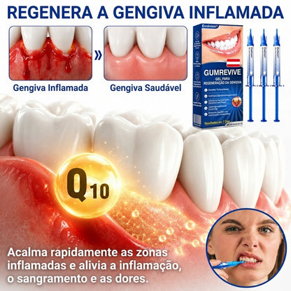 🇵🇹 Loja oficial |👨‍⚕️ ❤️ Evolvion® GumRevive — Gel de reparação periodontal | Certificado pela Ordem dos Médicos Dentistas (OMD)