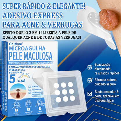 🏆Celsiora® Adesivos 2 em 1 de Microagulhas e Hidrocoloide | Removedor de Sinais Elevados🍒🍒