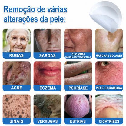 🏆Celsiora® Adesivos 2 em 1 de Microagulhas e Hidrocoloide | Removedor de Sinais Elevados🍒🍒
