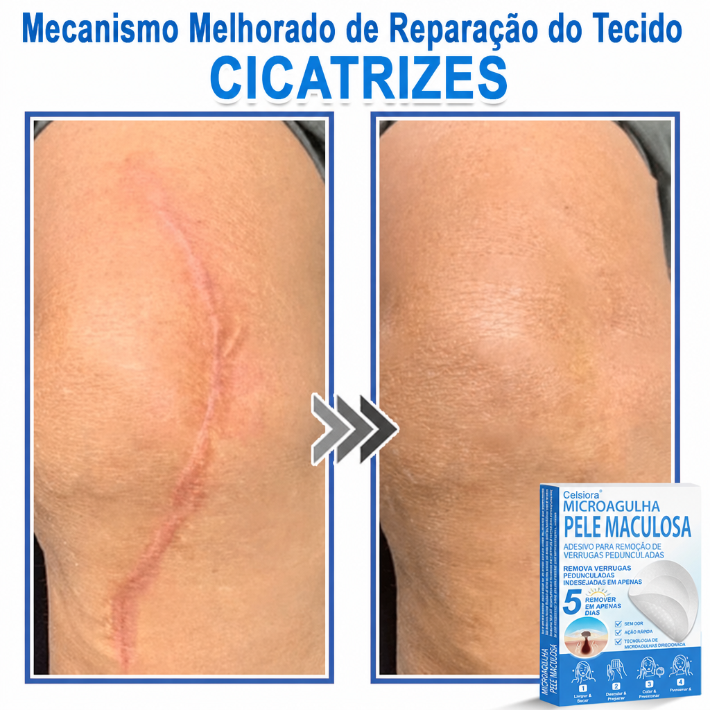 🏆Celsiora® Adesivos 2 em 1 de Microagulhas e Hidrocoloide | Removedor de Sinais Elevados🍒🍒