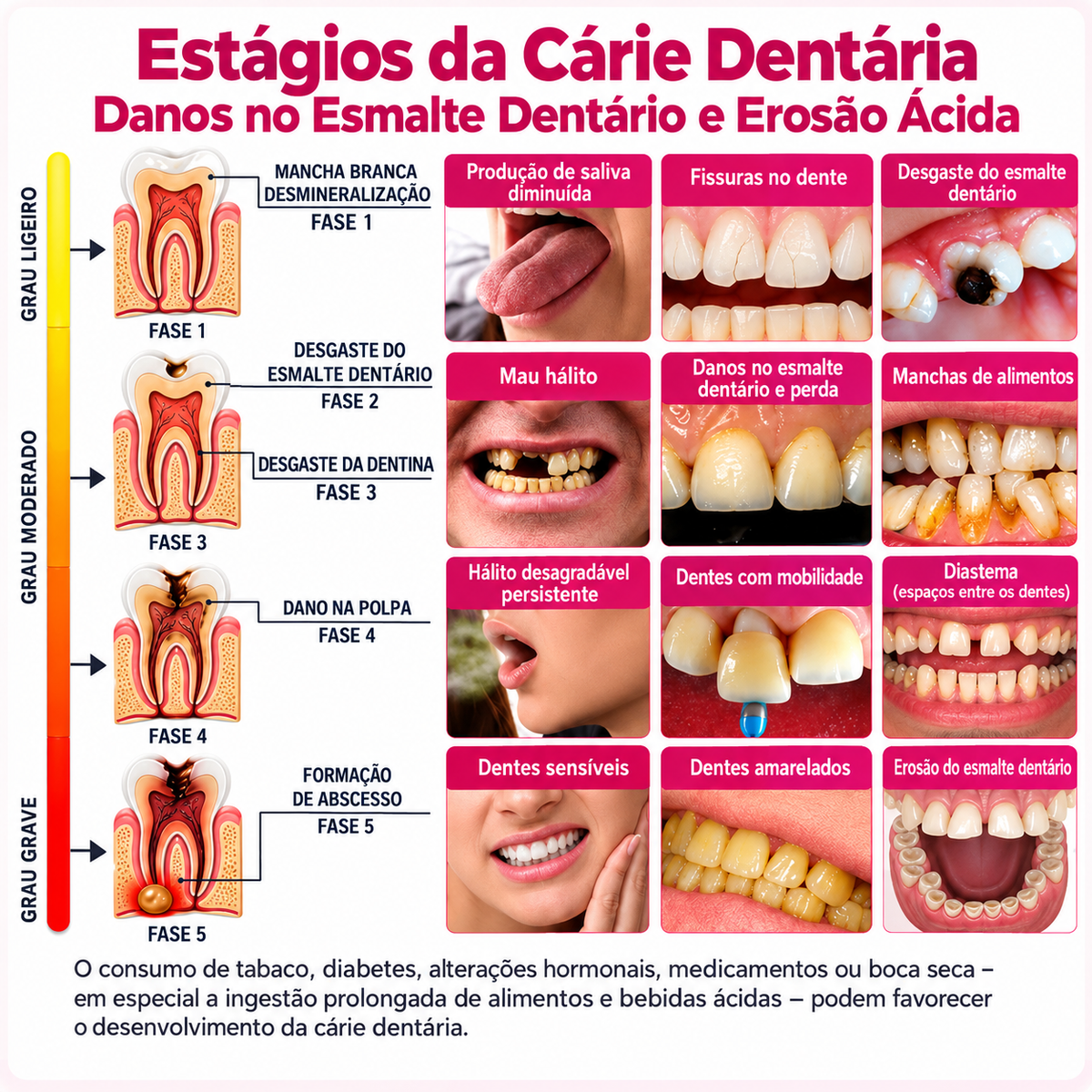 🇵🇹 Loja Oficial |🦷🎄Rolimey® DenPerm – Gel natural de preenchimento do esmalte dentário para o tratamento de cáries